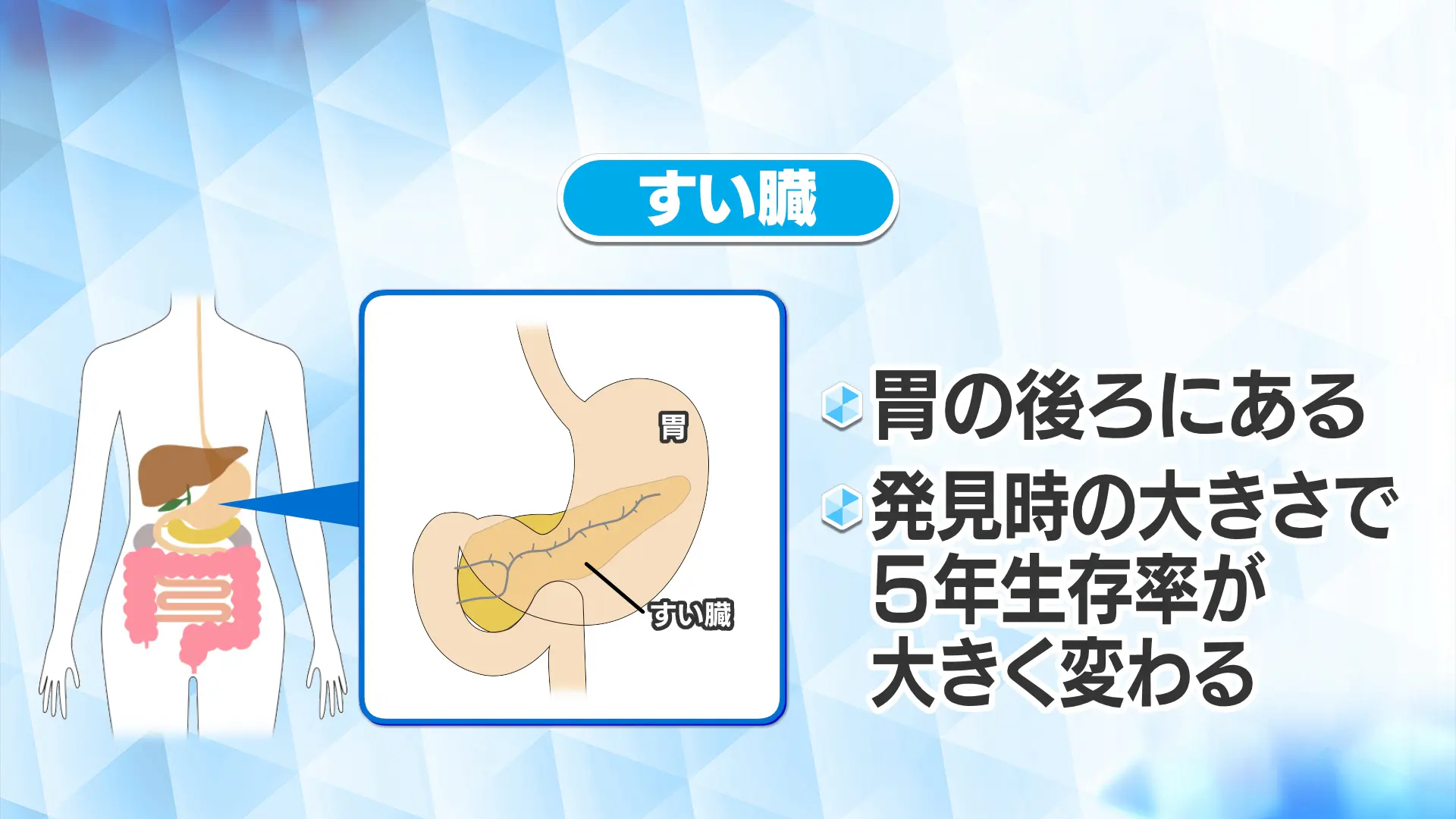 要警戒！初期は無症状のすい臓がん。早期発見できる？【いっ